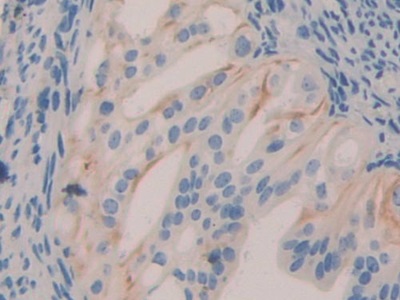 Polyclonal Antibody to Serum/Glucocorticoid Regulated Kinase 3 (SGK3)