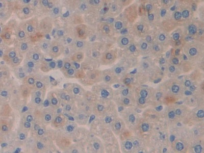 Polyclonal Antibody to Serum/Glucocorticoid Regulated Kinase 3 (SGK3)