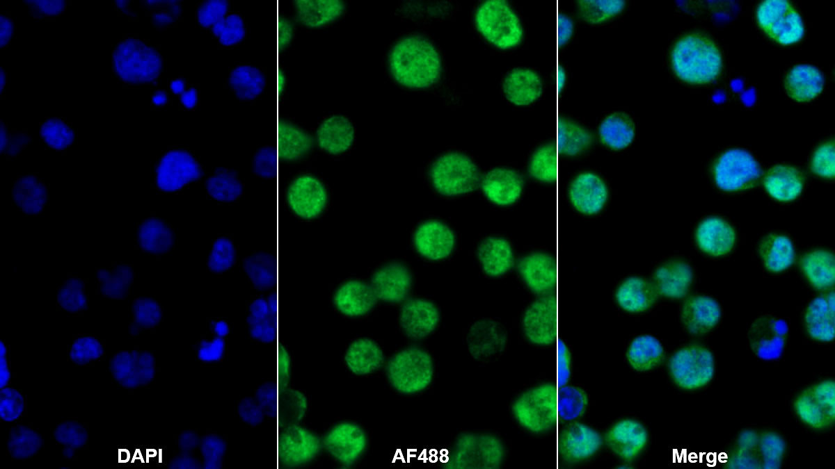 Polyclonal Antibody to B-Cell CLL/Lymphoma 11A (Bcl11A)