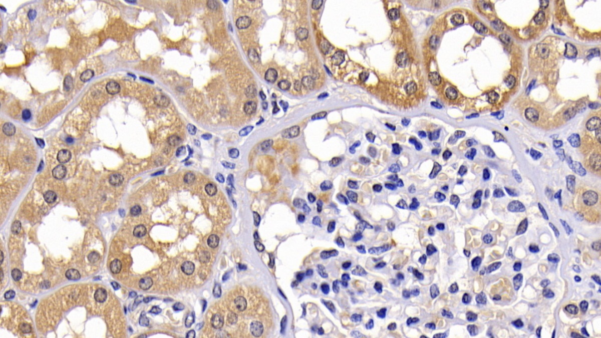 Polyclonal Antibody to B-Cell CLL/Lymphoma 2 Like Protein (Bcl2L)