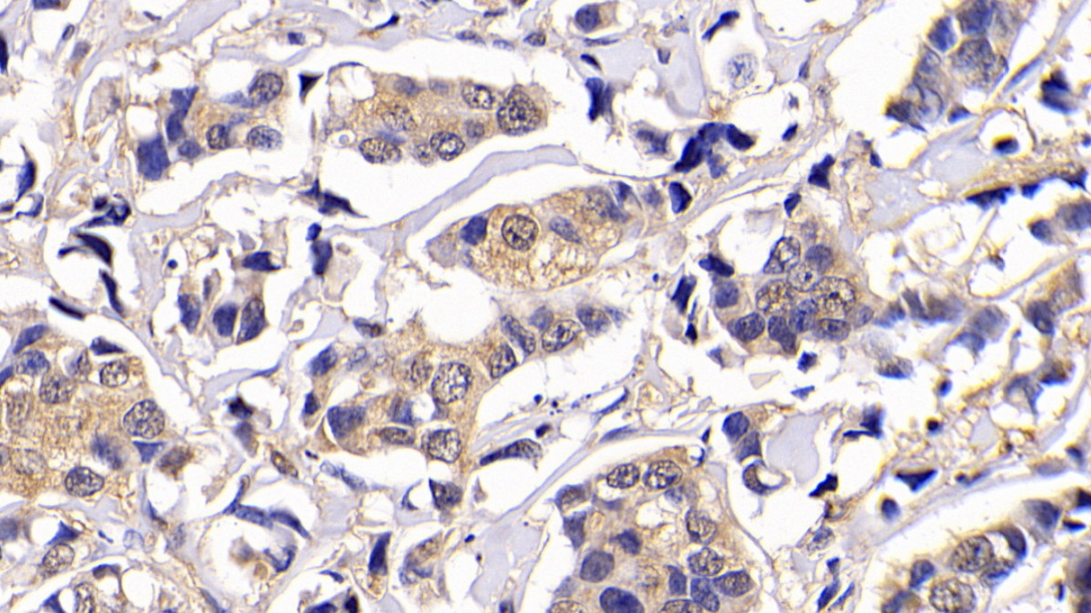 Polyclonal Antibody to B-Cell CLL/Lymphoma 2 Like Protein (Bcl2L)