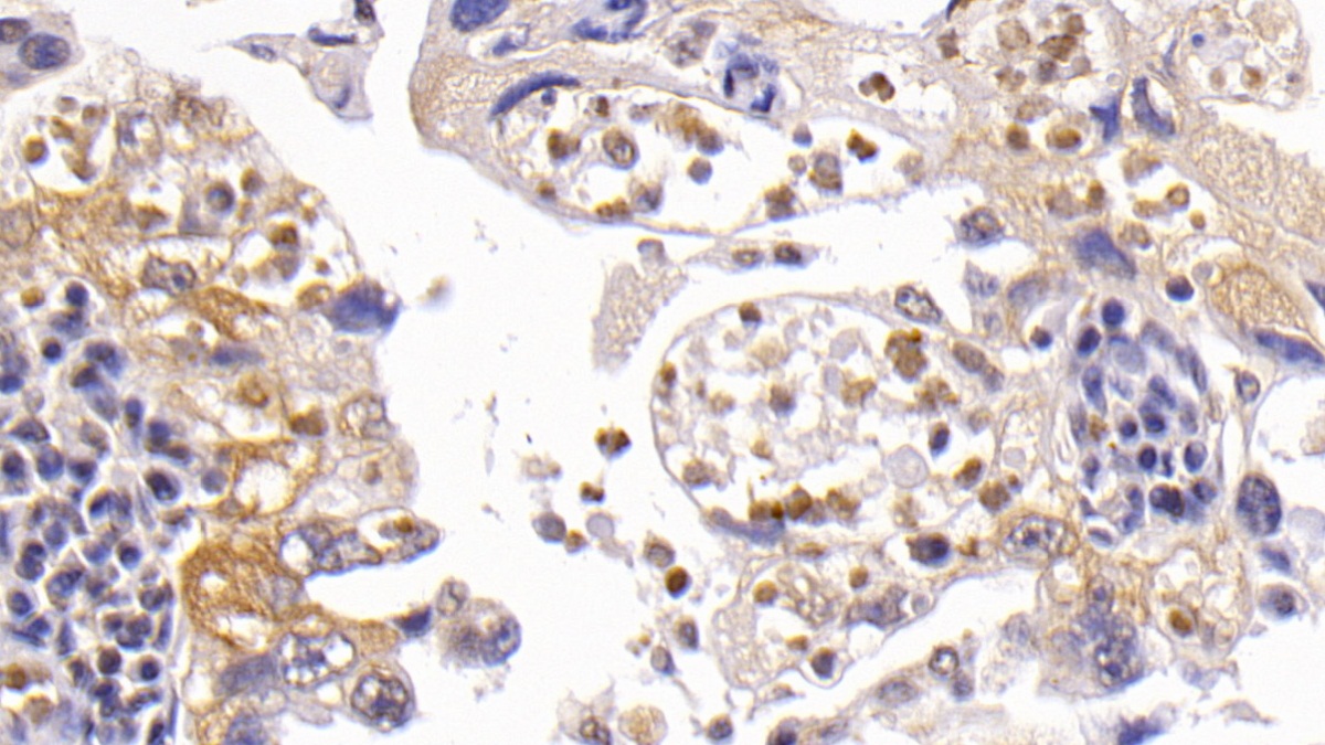 Polyclonal Antibody to B-Cell CLL/Lymphoma 2 Like Protein (Bcl2L)