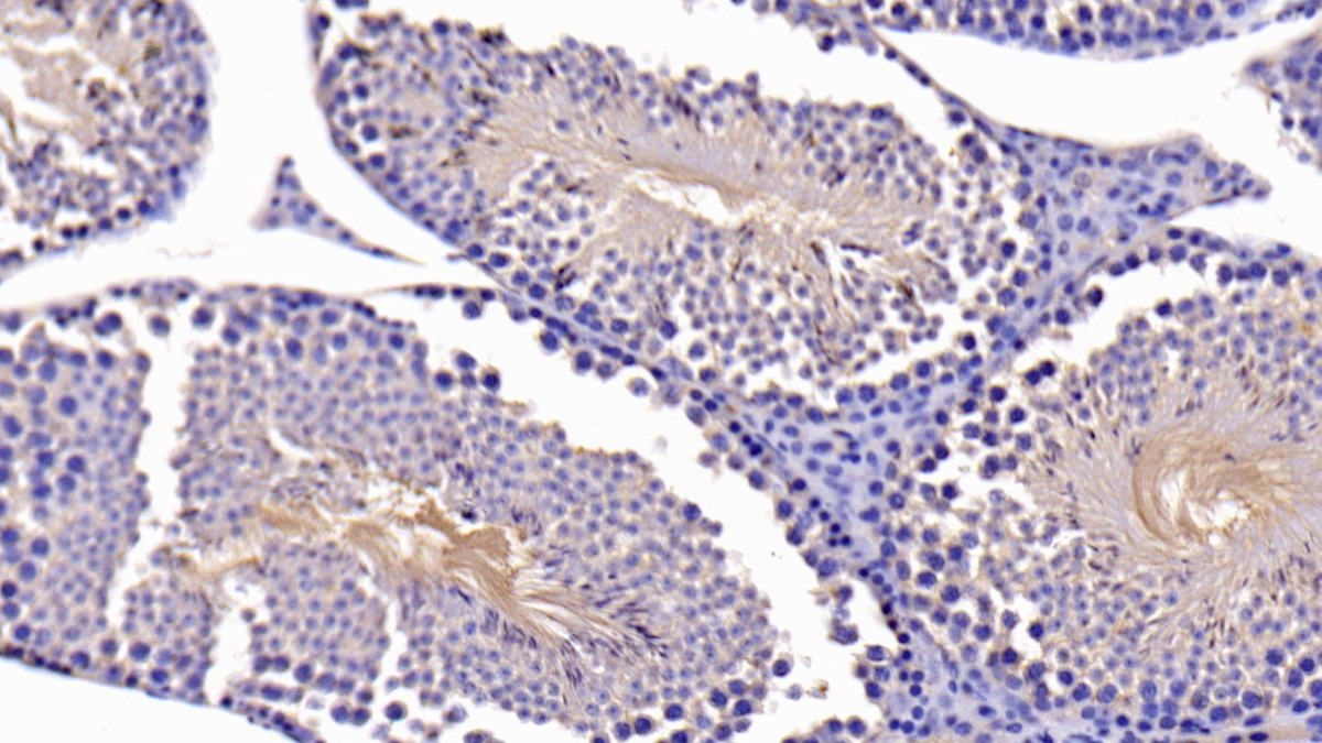 Polyclonal Antibody to B-Cell CLL/Lymphoma 2 Like Protein (Bcl2L)