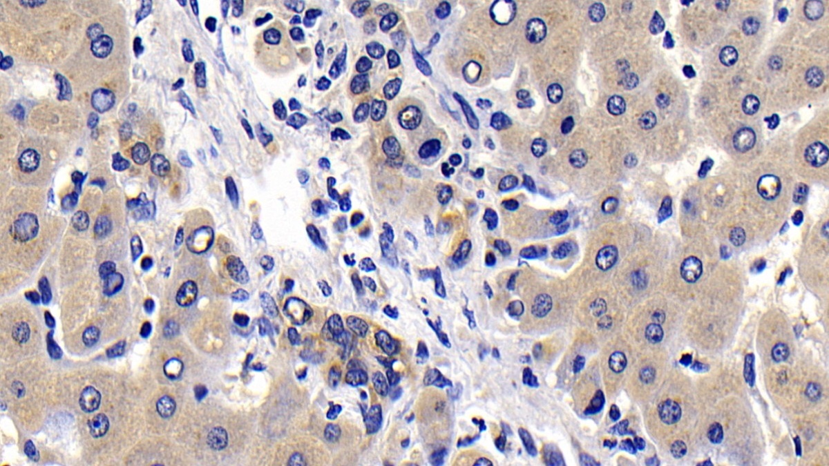 Polyclonal Antibody to B-Cell CLL/Lymphoma 2 Like Protein (Bcl2L)