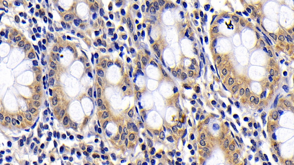 Polyclonal Antibody to B-Cell CLL/Lymphoma 2 Like Protein (Bcl2L)