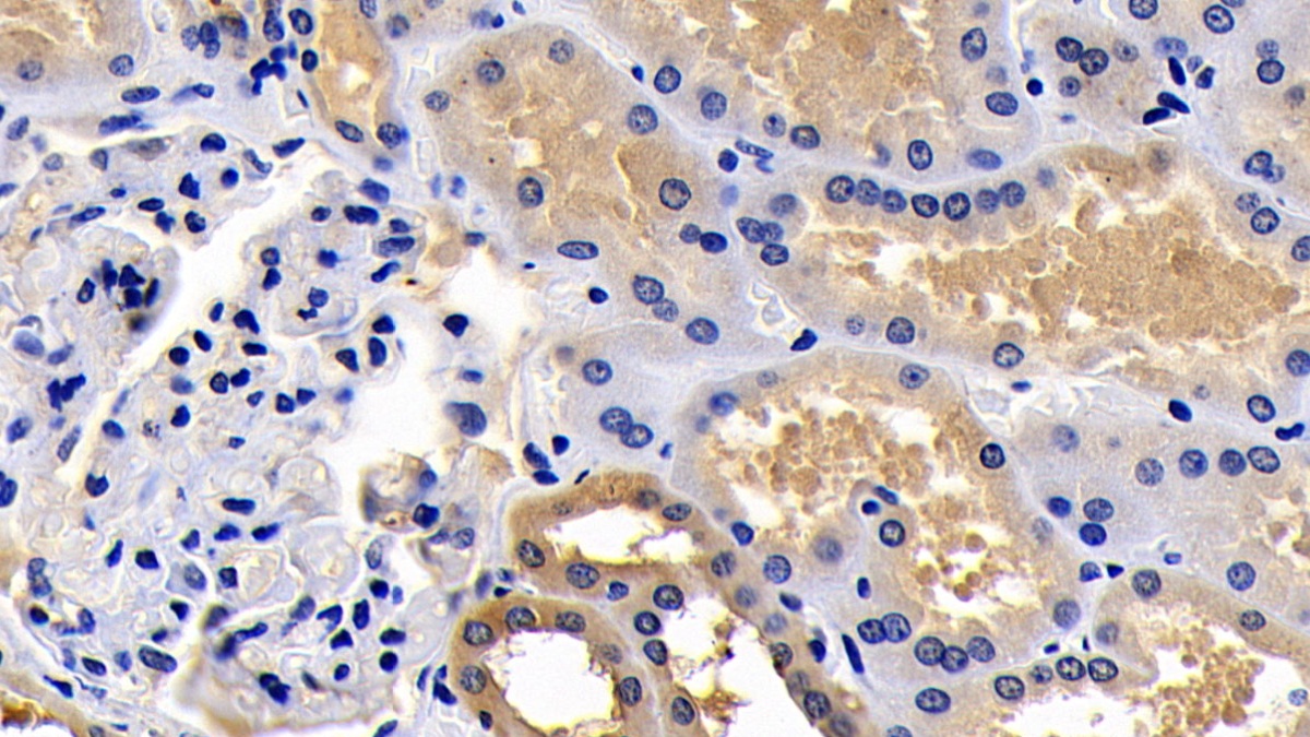 Polyclonal Antibody to B-Cell CLL/Lymphoma 2 Like Protein (Bcl2L)