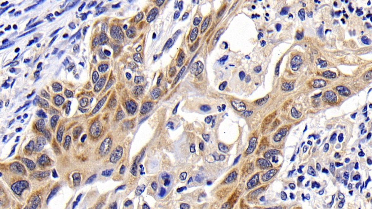 Polyclonal Antibody to B-Cell CLL/Lymphoma 2 Like Protein (Bcl2L)