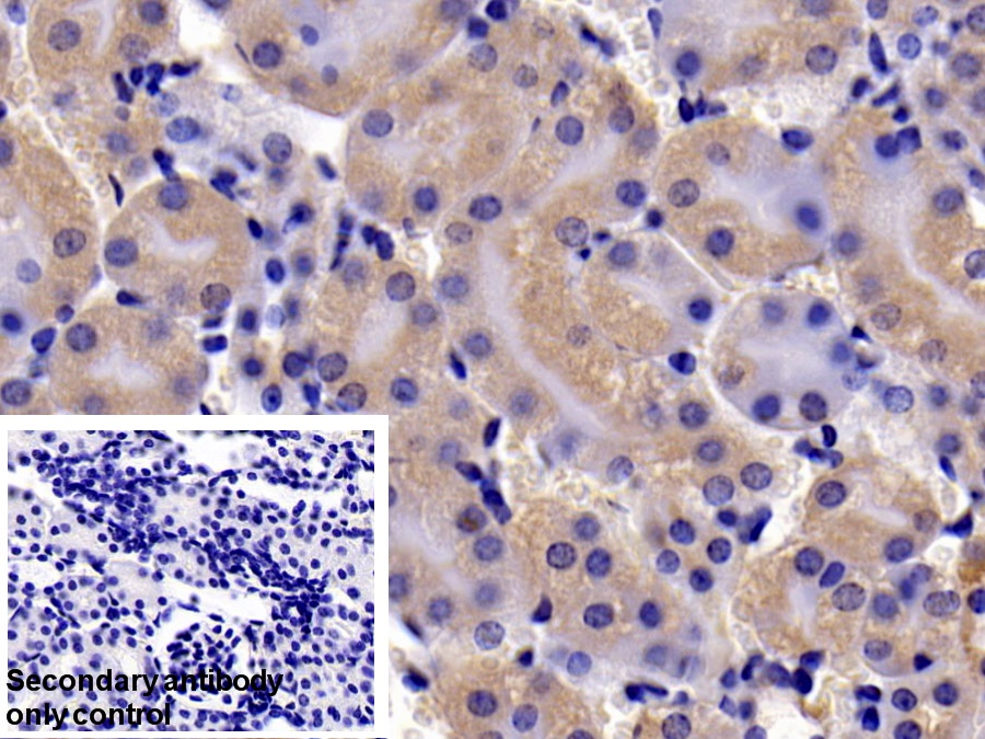 Polyclonal Antibody to B-Cell CLL/Lymphoma 2 Like Protein (Bcl2L)