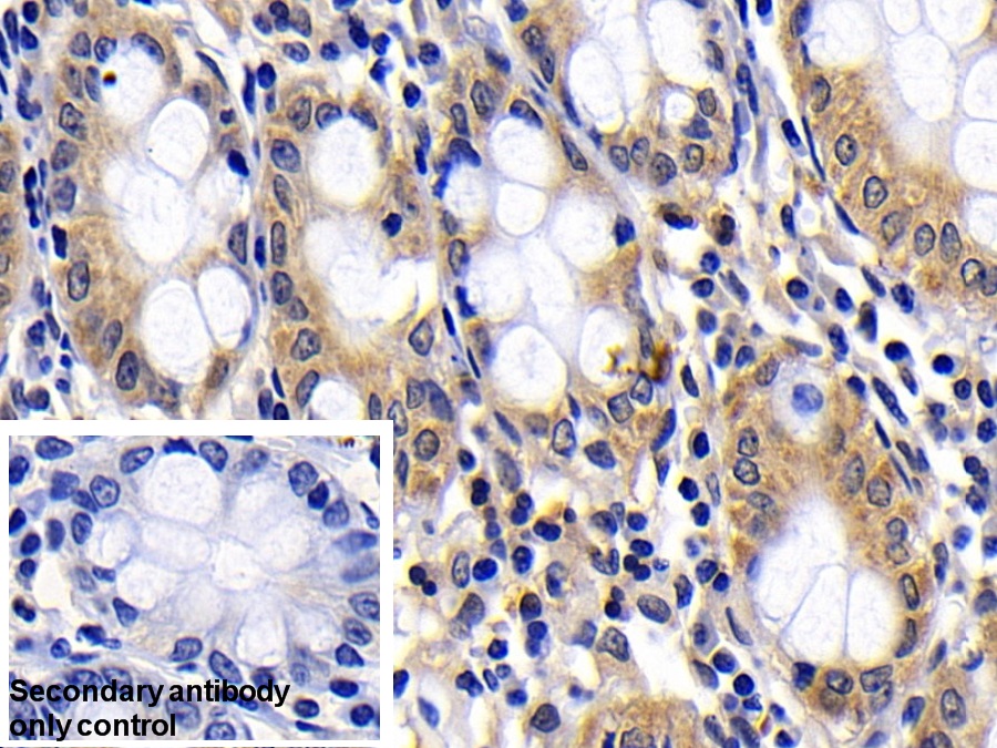 Polyclonal Antibody to B-Cell CLL/Lymphoma 2 Like Protein (Bcl2L)