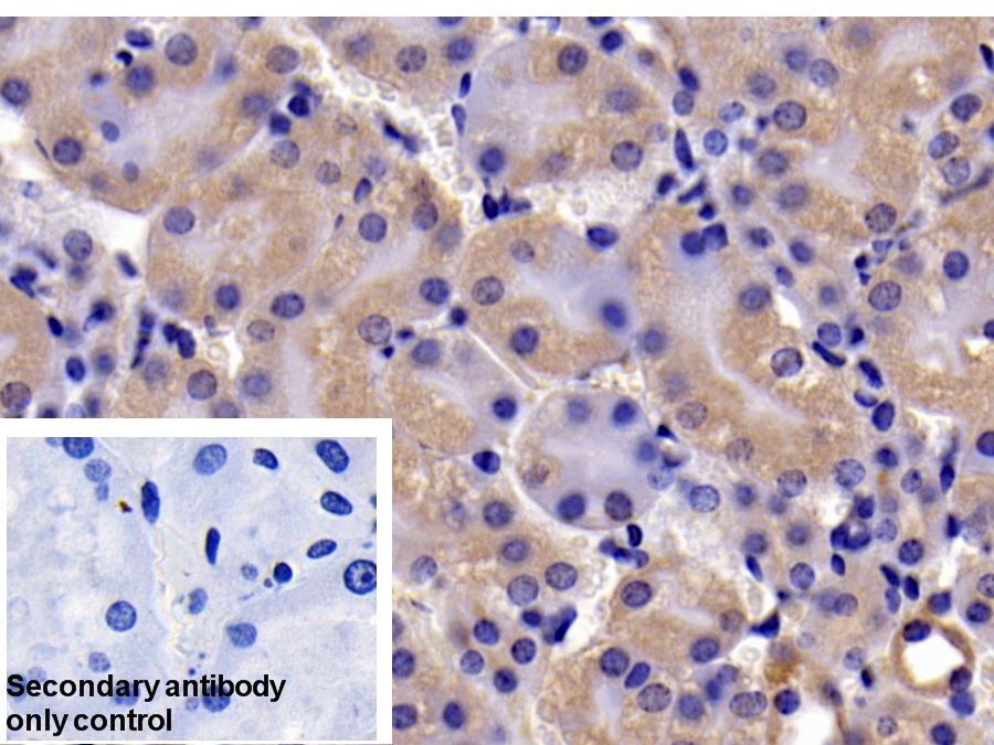 Polyclonal Antibody to B-Cell CLL/Lymphoma 2 Like Protein (Bcl2L)