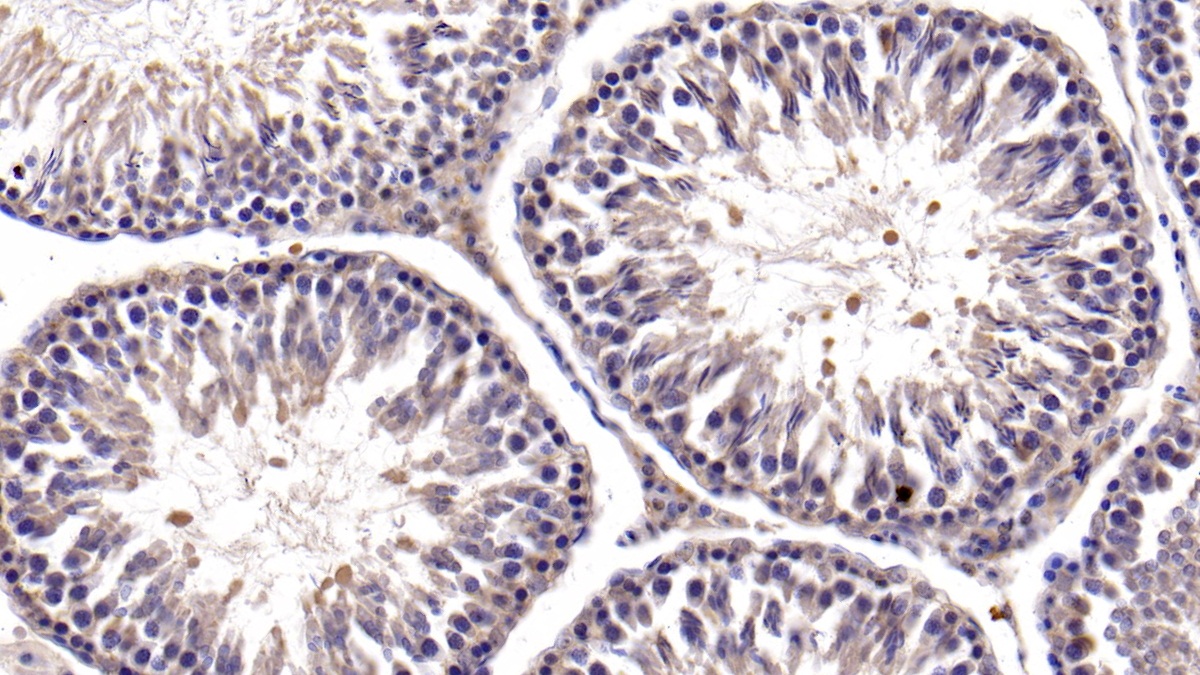 Polyclonal Antibody to B-Cell CLL/Lymphoma 2 Like Protein (Bcl2L)