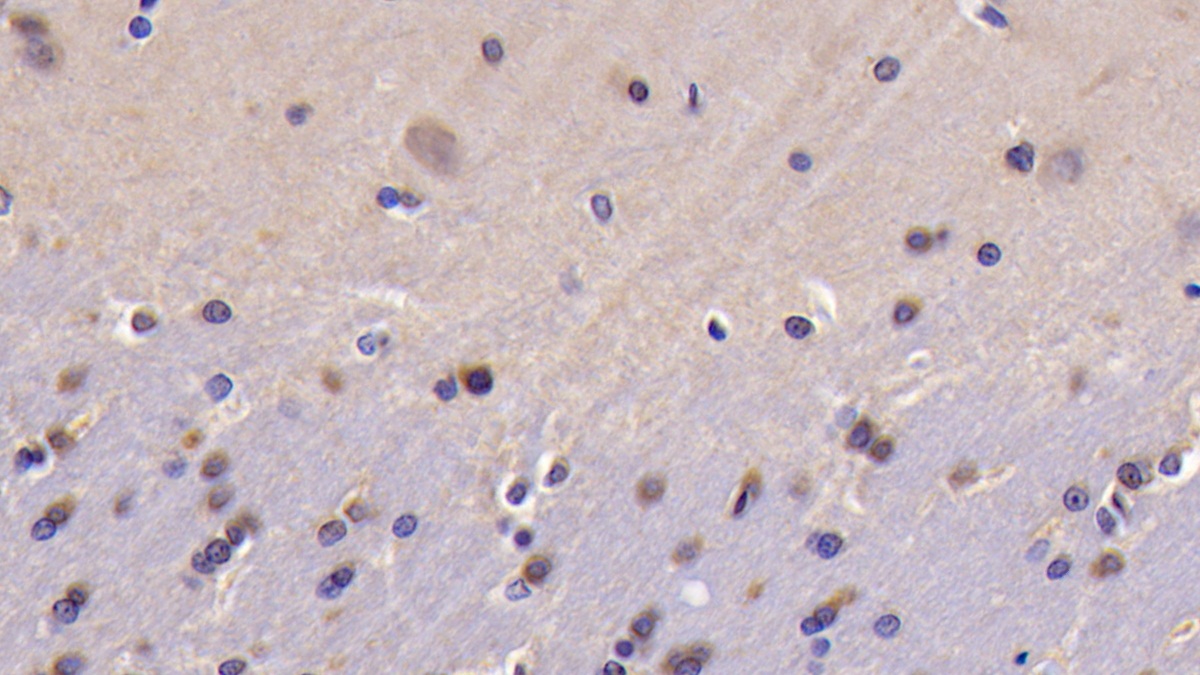 Polyclonal Antibody to B-Cell CLL/Lymphoma 2 Like Protein (Bcl2L)