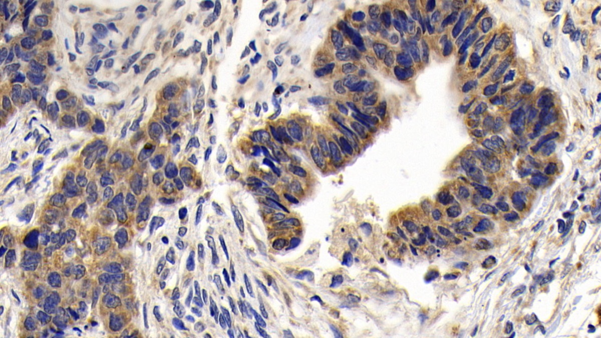 Polyclonal Antibody to B-Cell CLL/Lymphoma 2 Like Protein (Bcl2L)