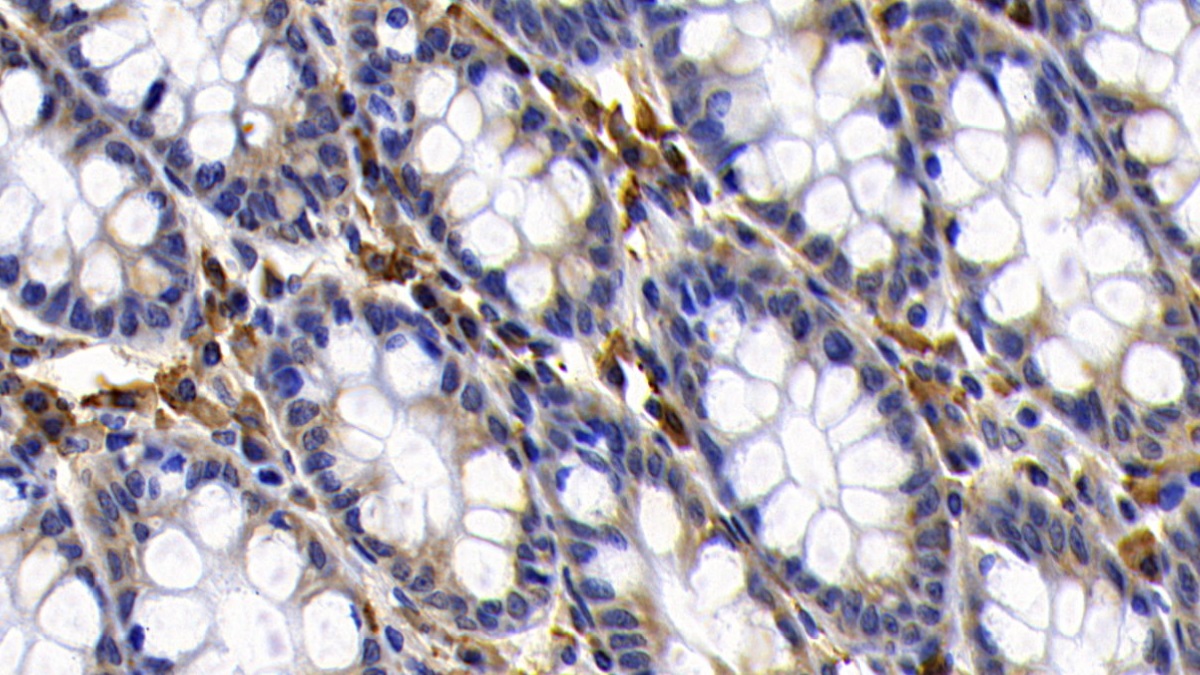 Polyclonal Antibody to B-Cell CLL/Lymphoma 2 Like Protein (Bcl2L)