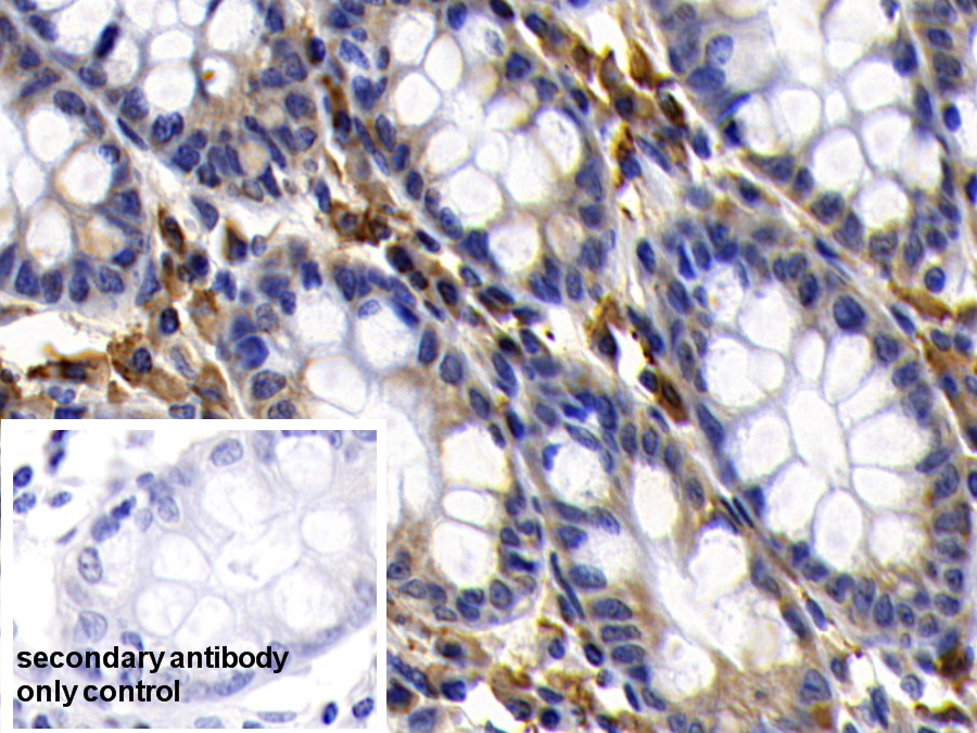 Polyclonal Antibody to B-Cell CLL/Lymphoma 2 Like Protein (Bcl2L)