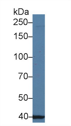 Polyclonal Antibody to Ubiquitin Associated Protein 2 (UBAP2)