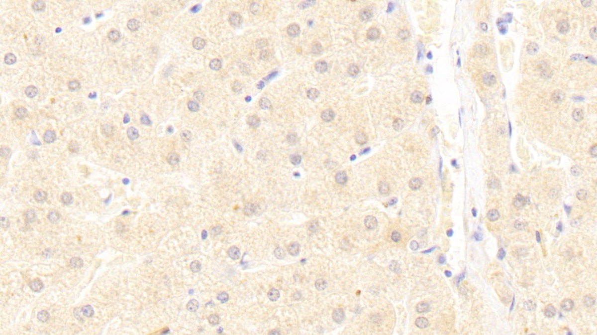 Polyclonal Antibody to Ubiquitin Associated Protein 2 (UBAP2)