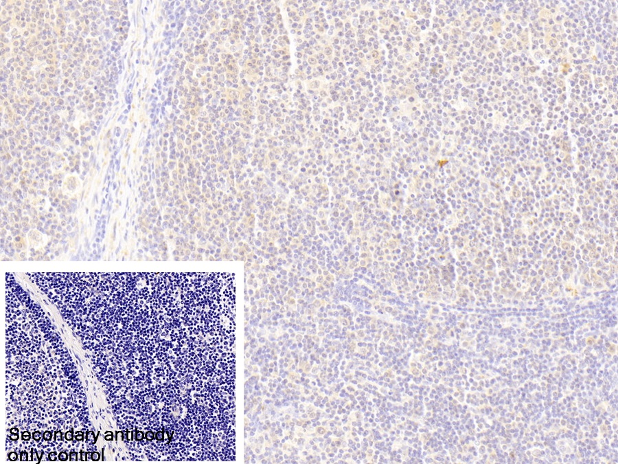 Polyclonal Antibody to Ubiquitin Associated Protein 2 (UBAP2)