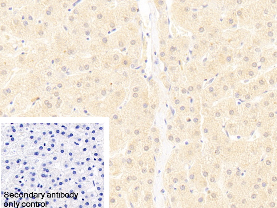 Polyclonal Antibody to Ubiquitin Associated Protein 2 (UBAP2)