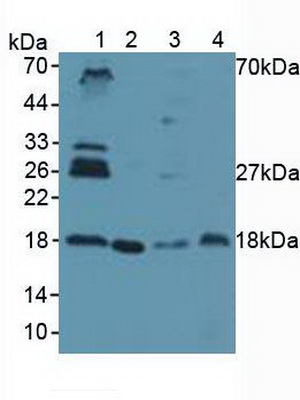 Polyclonal Antibody to Ubiquitin Conjugating Enzyme E2I (UBE2I)