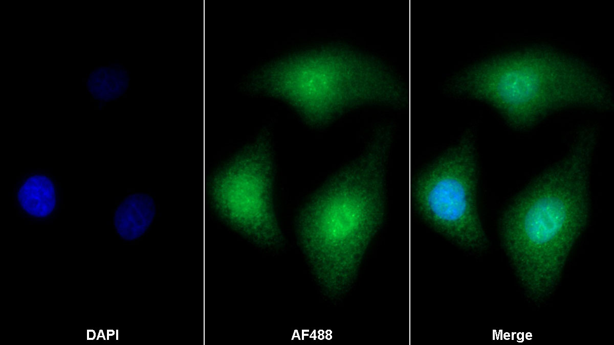 Polyclonal Antibody to Ubiquitin Conjugating Enzyme E2I (UBE2I)