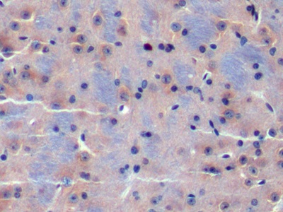 Polyclonal Antibody to Cyclin Dependent Kinase 18 (CDK18)