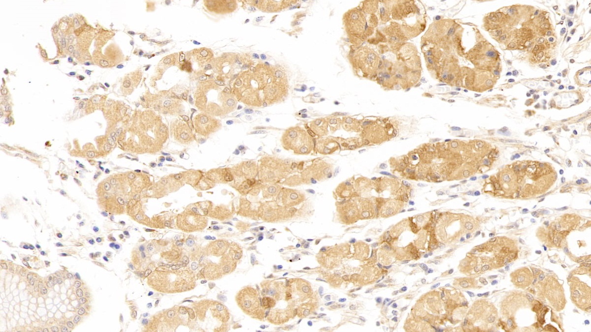 Polyclonal Antibody to Cyclin Dependent Kinase Inhibitor 1A (CDKN1A)