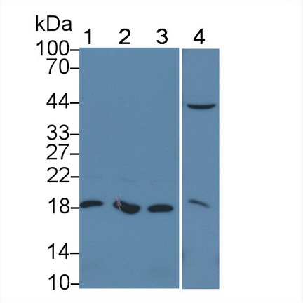 Polyclonal Antibody to Cyclin Dependent Kinase Inhibitor 1A (CDKN1A)