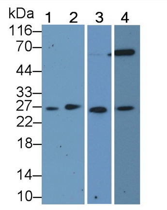 Polyclonal Antibody to Cyclin Dependent Kinase Inhibitor 1B (CDKN1B)