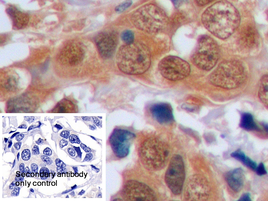 Polyclonal Antibody to Cyclin Dependent Kinase Inhibitor 1B (CDKN1B)