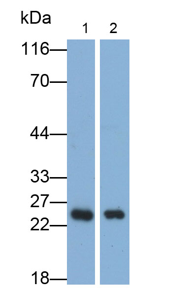 Polyclonal Antibody to Cyclin Dependent Kinase Inhibitor 1B (CDKN1B)