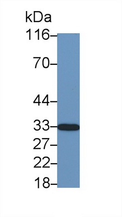 Polyclonal Antibody to Cyclin Dependent Kinase Inhibitor 1B (CDKN1B)