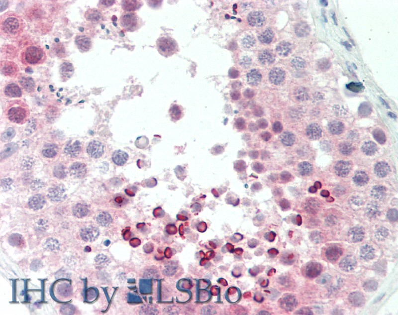 Polyclonal Antibody to Cyclin Dependent Kinase Inhibitor 2D (CDKN2D)