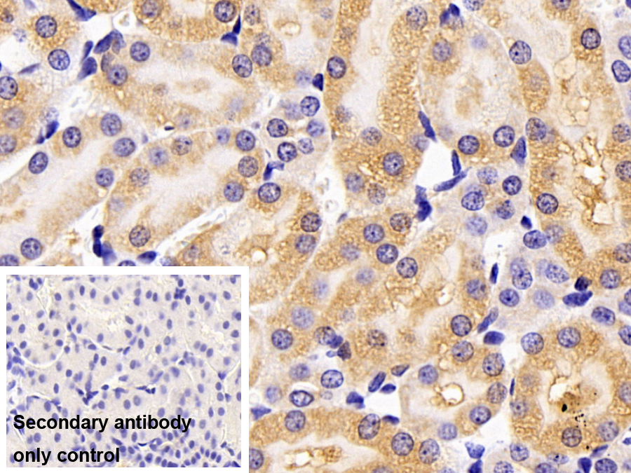 Polyclonal Antibody to Receptor Interacting Serine Threonine Kinase 3 (RIPK3)