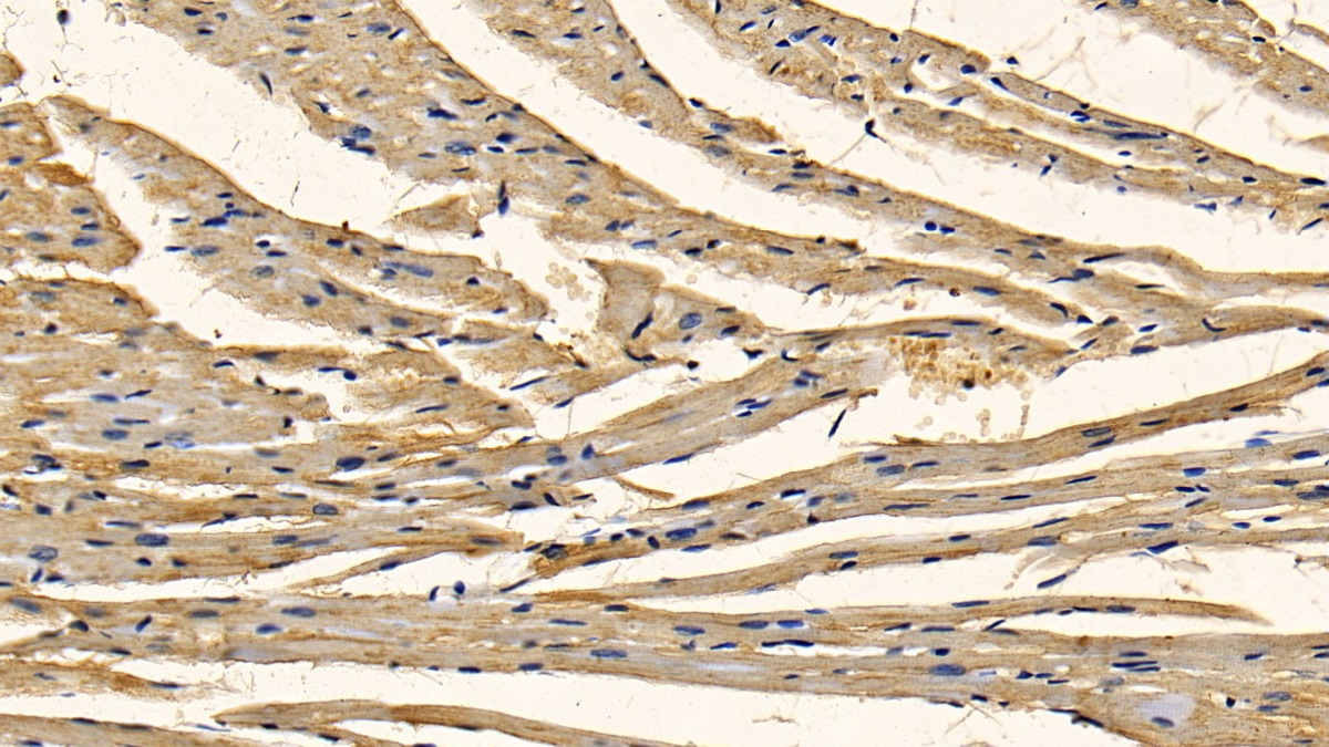 Polyclonal Antibody to Receptor Interacting Serine Threonine Kinase 1 (RIPK1)