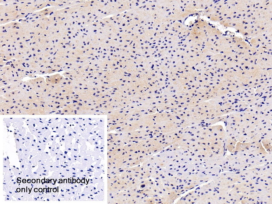 Polyclonal Antibody to FK506 Binding Protein 1B (FKBP1B)