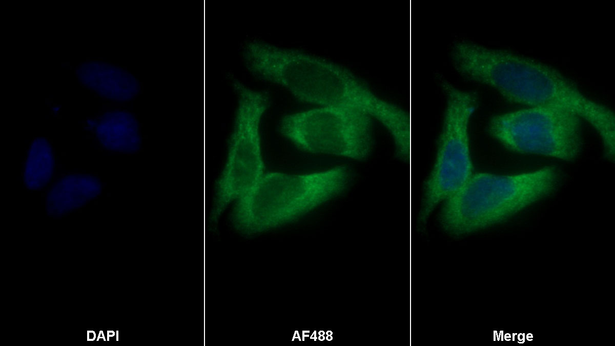 Polyclonal Antibody to FK506 Binding Protein 3 (FKBP3)