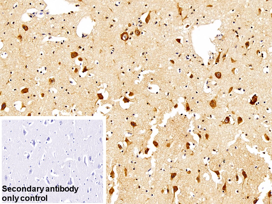 Polyclonal Antibody to FK506 Binding Protein 3 (FKBP3)