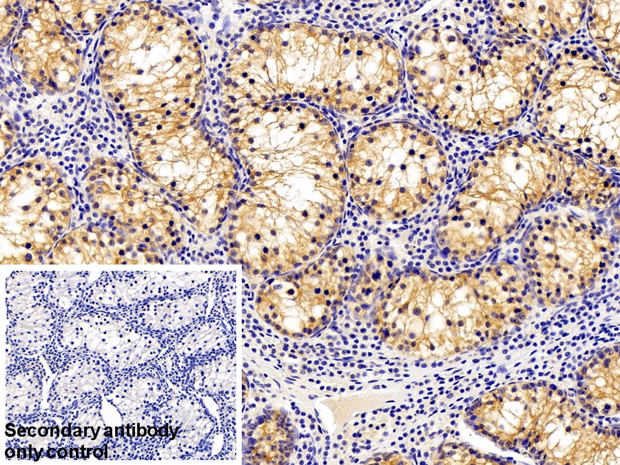 Polyclonal Antibody to FK506 Binding Protein 3 (FKBP3)