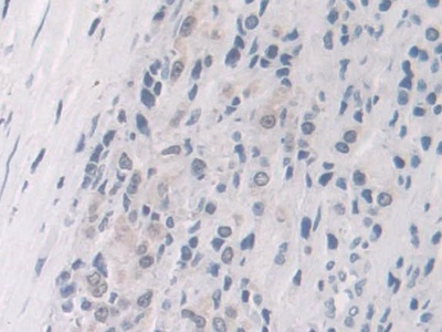 Polyclonal Antibody to FK506 Binding Protein 4 (FKBP4)