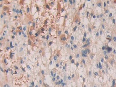 Polyclonal Antibody to SHC-Transforming Protein 3 (SHC3)