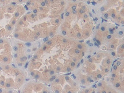 Polyclonal Antibody to SHC-Transforming Protein 3 (SHC3)