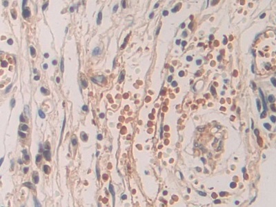 Polyclonal Antibody to SHC-Transforming Protein 3 (SHC3)