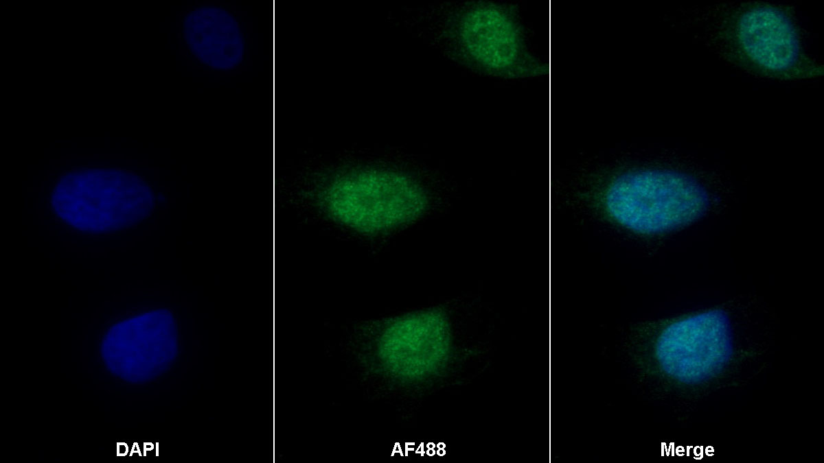 Polyclonal Antibody to SHC-Transforming Protein 3 (SHC3)