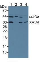 Polyclonal Antibody to Hydroxymethylbilane Synthase (HMBS)