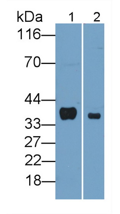 Polyclonal Antibody to FK506 Binding Protein 7 (FKBP7)