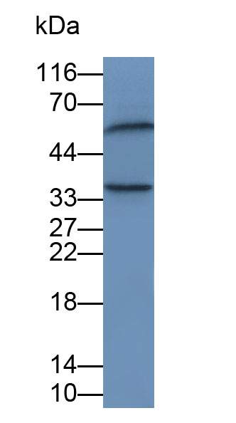 Polyclonal Antibody to FK506 Binding Protein 8 (FKBP8)