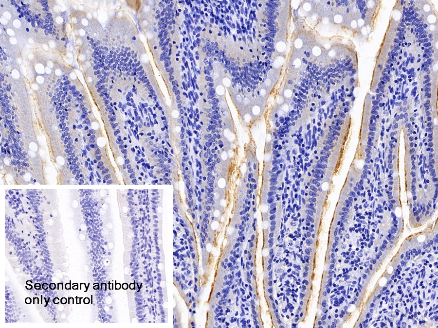 Polyclonal Antibody to N-Acylsphingosine Amidohydrolase 2 (ASAH2)