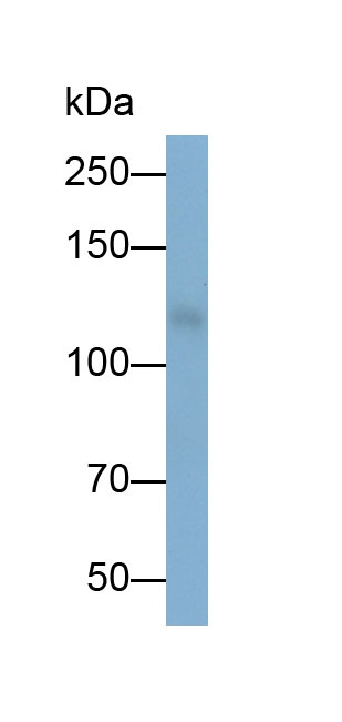 Polyclonal Antibody to N-Acylsphingosine Amidohydrolase 2 (ASAH2)