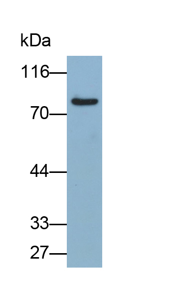 Polyclonal Antibody to N-Acylsphingosine Amidohydrolase 2 (ASAH2)